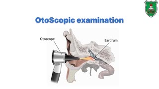 Otoscopic Examination [upl. by Reynold]