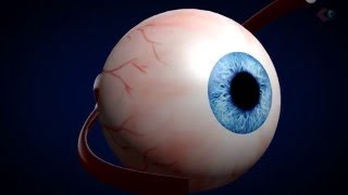 Lasik animation [upl. by Acemahs]