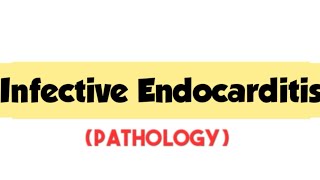 Infective Endocarditiscardiovascular pathologyRobbins pathologymbbsforward focused [upl. by Travis]