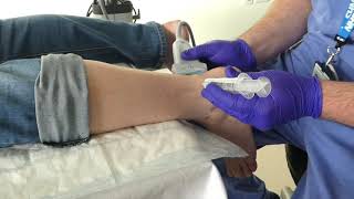 Injection  posterior heel USS guided highvolume injections [upl. by Moreville]