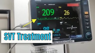 Adenosine in Supraventricular tachycardia SVT How to administer and how it works [upl. by Eziechiele]