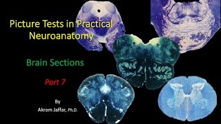 Picture Test in Neuroanatomy Brain Sections 7 [upl. by Bethany]