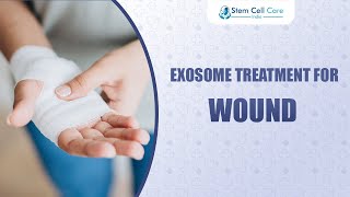 Exosome Treatment For Wound  Wound Healing  Stem Cells  Regenerative Medicine  Exosome Therapy [upl. by Trumaine]