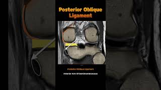 Fig 1A15 Additional peripheral attachments to the MM [upl. by Dianuj862]