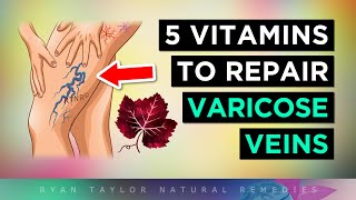 5 Vitamins For Venous Insufficiency VARICOSE Veins Remedies [upl. by Lleze]