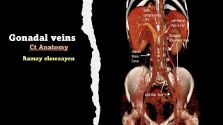 gonadal vien anatomy [upl. by Eniamsaj]