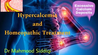 Hypercalcemia in Homeopathy [upl. by Grof]