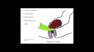 Anismus  Symptoms and Causes  Diagnosis  Treatment  Prevention healthcare health [upl. by Cutcliffe]