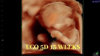 Ultrasonido 5D 13 semanas de embarazo😍 eco 13 semanas de gestacion  13 weeks pregnant [upl. by Orose]