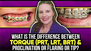 Torque vs Proclination  Tip Explained in Braces and Invisalign [upl. by Thirza]