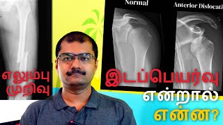 What is the difference between a dislocate and a break Dr Soundar I Tamil [upl. by Mikes]