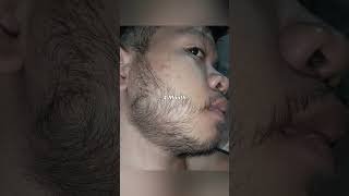 Kirkland Minoxidil Beard Journey 4 MONTH TRANSFORMATION [upl. by Nalla]