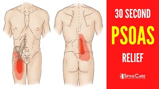 How to Fix a Tight Psoas Muscle in 30 SECONDS [upl. by Crane]