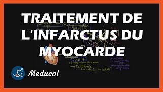 Traitement infarctus du myocarde  médicaments de lurgence thrombolyse et traitement au long cours [upl. by Laurie628]