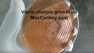 Vibrio cholerae colonies characteristics on Macconkey medium [upl. by Richy717]