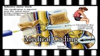 Coding Nerve Block Follow Up  Medical Coding Training [upl. by Qifar447]