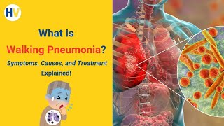 What Is Walking Pneumonia Symptoms Causes and Treatment Explained [upl. by Abigael]