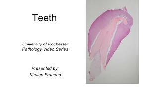 Histology of the Tooth [upl. by Hehre]