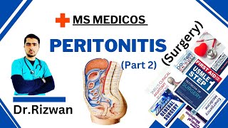 Peritonitis Part 2SurgeryMS MedicosDr RizwanUrdu Hindi Easy Explanations [upl. by Marys]