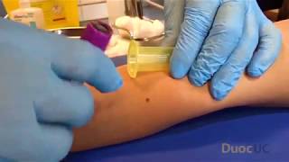 PUNCION VENOSA CON VACUTAINER [upl. by Wedurn]