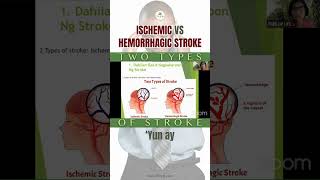 Ischemic Vs Hemorrhagic Stroke [upl. by Kato]