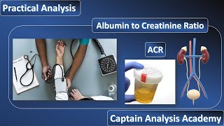 E16Albumin to Creatinine RatioMicroalbuminuriaكل ما يخص تحليل الميكروالبيومين فى البول نظرى عملى [upl. by Osmo]