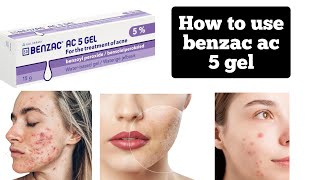 Benzac Ac benzole peroxide 50 mg active acne treatmentshrink open poresclean dark spot [upl. by Eemyaj]