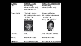 what are the differences between Fanconi anemia amp fetal alcohol syndrome radial limb anomalies [upl. by Faludi]