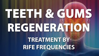 Teeth and Gums Regeneration Tooth  RIFE Frequencies Treatment  Energy amp Quantum Medicine [upl. by Aicirt]