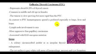 Follicular Thyroid Carcinoma FTC [upl. by Kellda]