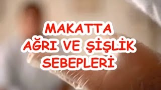 MAKATTA AĞRI VE ŞİŞLİK SEBEPLERİ [upl. by Coppock]