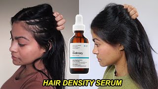 I tried The Ordinary Hair Density Serum for 1 YEAR amp THIS HAPPENED  Before and after results [upl. by Irol]