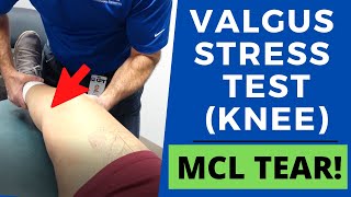 Valgus Stress Test of the KneePositive Test [upl. by Pontone814]