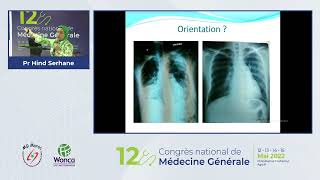 Lecture de la radiographie pulmonaire Pr Hind Serhane [upl. by Amilb674]