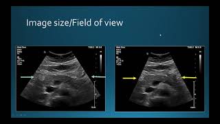 Abdominal usgphysics and technique [upl. by Ydur]