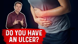 Understanding Ulcers How Do You Know If You Have One – Dr Berg [upl. by Ethelred]