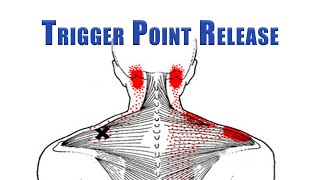 Trigger Point Release  Upper Trapezius Levator Scapulae and Suboccipitals  No Tools Needed [upl. by Cassondra]