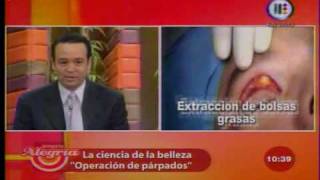 Dr Jaime Rodriguez Sierra Blefaroplastia Venga la Alegria Crugia Plastica [upl. by Ahtenek961]