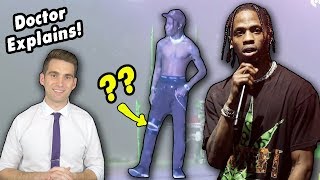 Travis Scott DISLOCATED his Knee and Still Performed Doctor Explains Possible Injury [upl. by Yerac]