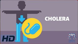 CHOLERA Everything You Need To Know [upl. by Steward]