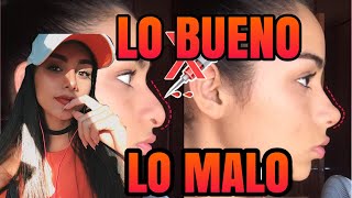 Lo BUENO y lo MALO Respingadores nasales  Rinoplastia Casera en minutos [upl. by Harmony178]