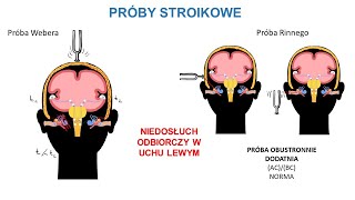 Próby stroikowe subiektywne badanie słuchu Próba Rinnego próba Webera [upl. by Snapp]