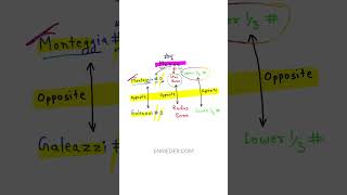 Galeazzi fracture enmeder [upl. by Dalia]