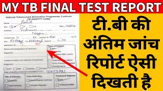 My TB Final Test Report LIVE  मेरी टीबी जांच की अंतिम रिपोर्ट [upl. by Ahsii]