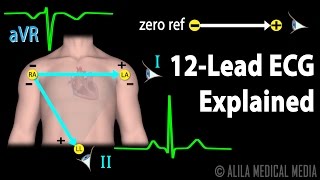 12 Lead ECG Explained Animation [upl. by Ettesel986]