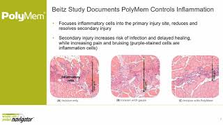 Reducing Pain and Encouraging Healing PolyMem® Wound Dressings  Clip 4 [upl. by Eikcaj]