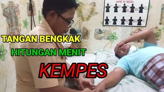 TANGAN BENGKAK HITUNGAN MENIT KEMPES by Ibu Nila [upl. by Schulein]