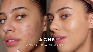 HOW TO COVER ACNE WITH MAKEUP BASE ROUTINE [upl. by Acissaj]