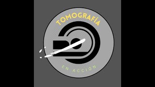 Tomografia en Accion  Capitulo 1 [upl. by Higinbotham]