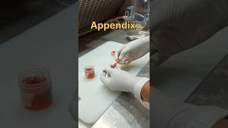 Appendix specimen grossing for tissue processing in histopathology [upl. by Aicirpac]